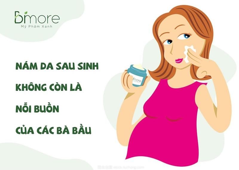 Để nám da sau sinh không còn là nỗi buồn của các bà bầu