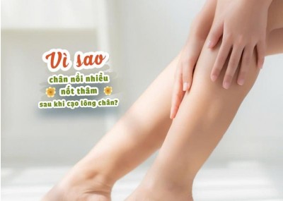 Vì sao chân nổi nhiều nốt thâm sau khi cạo lông chân? 