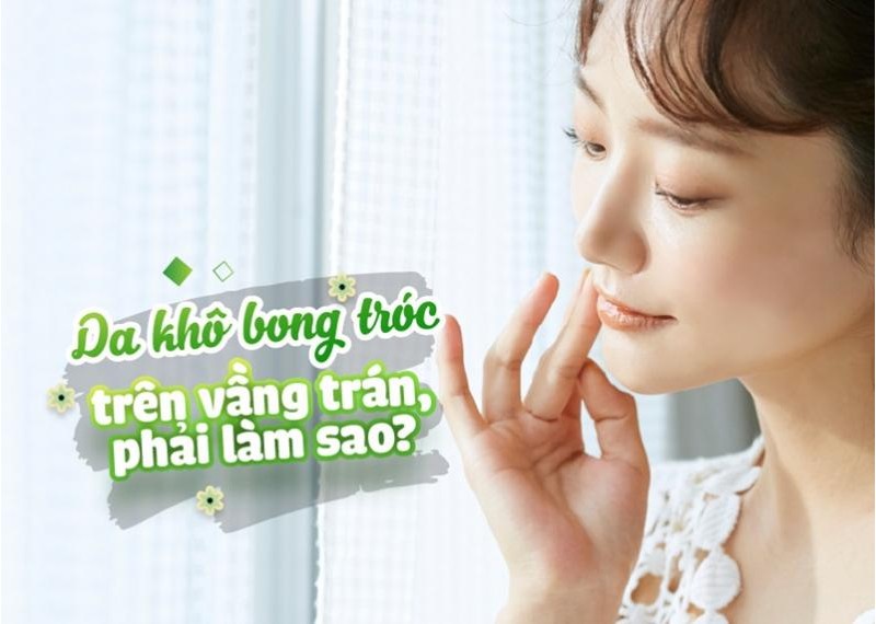 Da khô bong tróc trên vầng trán, phải làm sao? 