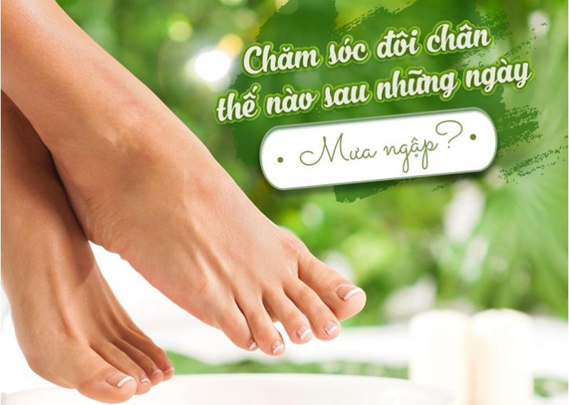 Chăm sóc đôi chân thế nào sau những ngày mưa ngập?